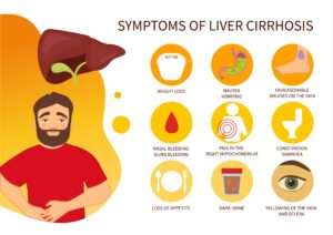 Symptom of liver disease