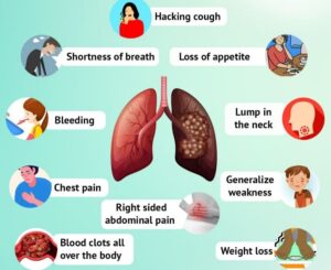 Symptoms
