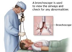 Bronchoscopy