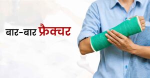 बार-बार फ्रैक्चर होना