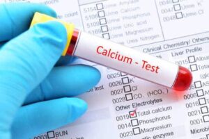 Calcium test